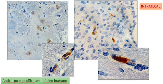 Biodistribuição CTIPDs - Intratecal