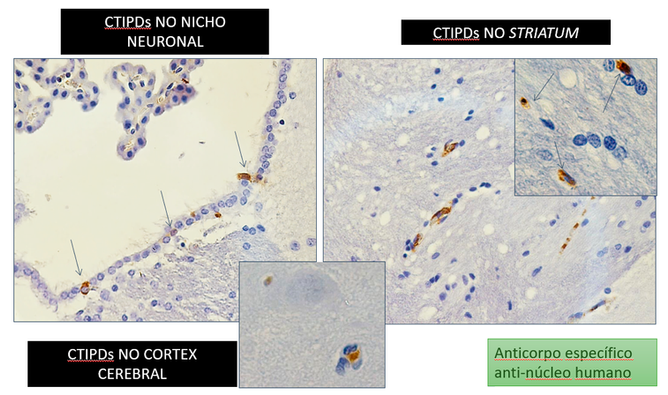 Biodistribuição CTIPDs