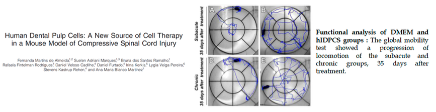 Modelo Murino de Doença de Huntington